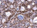 MCM6 Antibody in Immunohistochemistry (Paraffin) (IHC (P))