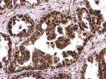 MCM6 Antibody in Immunohistochemistry (Paraffin) (IHC (P))