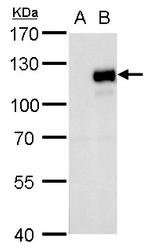 MKL1 Antibody in Western Blot (WB)