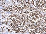 NAV2 Antibody in Immunohistochemistry (Paraffin) (IHC (P))