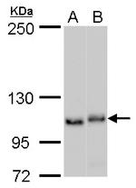 NOLC1 Antibody in Western Blot (WB)