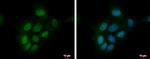 ZMYND8 Antibody in Immunocytochemistry (ICC/IF)