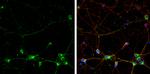 RPH3A Antibody in Immunocytochemistry (ICC/IF)