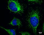 FIP200 Antibody in Immunocytochemistry (ICC/IF)