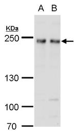 FIP200 Antibody in Western Blot (WB)