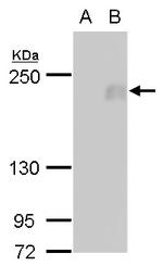 FIP200 Antibody in Western Blot (WB)