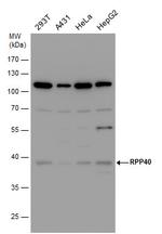 RPP40 Antibody in Western Blot (WB)