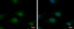 TBL3 Antibody in Immunocytochemistry (ICC/IF)