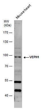 VEPH1 Antibody in Western Blot (WB)