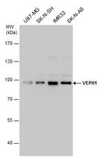 VEPH1 Antibody in Western Blot (WB)