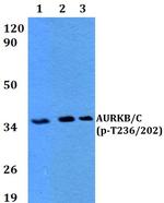 Phospho-Aurora B/C (Thr236, Thr202) Antibody in Western Blot (WB)