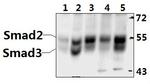 SMAD2/SMAD3 Antibody in Western Blot (WB)