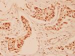 Cyclin A Antibody in Immunohistochemistry (Paraffin) (IHC (P))