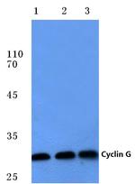 Cyclin G1 Antibody in Western Blot (WB)