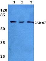 GAD67 Antibody in Western Blot (WB)