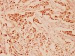 NRG1 Antibody in Immunohistochemistry (Paraffin) (IHC (P))