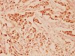 NRG1 Antibody in Immunohistochemistry (Paraffin) (IHC (P))