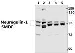 NRG1 Antibody in Western Blot (WB)