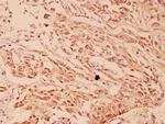 HSP105 Antibody in Immunohistochemistry (Paraffin) (IHC (P))