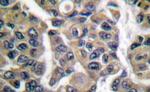 MAGE1 Antibody in Immunohistochemistry (Paraffin) (IHC (P))