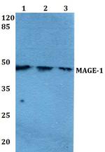 MAGE1 Antibody in Western Blot (WB)