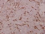 Sodium Channel Pan Antibody in Immunohistochemistry (Paraffin) (IHC (P))