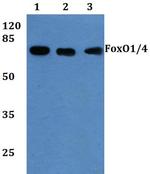 FOXO1/FOXO3/FOXO4 Antibody in Western Blot (WB)