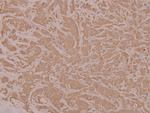 HYD Antibody in Immunohistochemistry (Paraffin) (IHC (P))