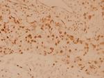 MSK1 Antibody in Immunohistochemistry (Paraffin) (IHC (P))