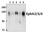 EphA2/EphA3/EphA4 Antibody in Western Blot (WB)