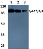 EphA2/EphA3/EphA4 Antibody in Western Blot (WB)