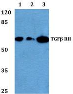 TGFBR2 Antibody in Western Blot (WB)