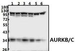 Aurora B/C Antibody in Western Blot (WB)