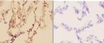 ADARB1 Antibody in Immunohistochemistry (Paraffin) (IHC (P))