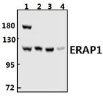 ARTS1 Antibody in Western Blot (WB)