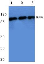 ARTS1 Antibody in Western Blot (WB)