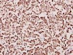 TAF6L Antibody in Immunohistochemistry (Paraffin) (IHC (P))