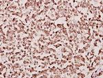 TAF6L Antibody in Immunohistochemistry (Paraffin) (IHC (P))