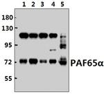 TAF6L Antibody in Western Blot (WB)