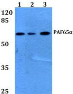 TAF6L Antibody in Western Blot (WB)