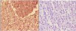 alpha Actinin 3 Antibody in Immunohistochemistry (Paraffin) (IHC (P))