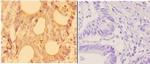 alpha Actinin 3 Antibody in Immunohistochemistry (Paraffin) (IHC (P))