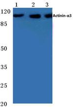 alpha Actinin 3 Antibody in Western Blot (WB)