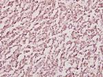 H-cadherin Antibody in Immunohistochemistry (Paraffin) (IHC (P))