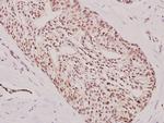 ATF3 Antibody in Immunohistochemistry (Paraffin) (IHC (P))