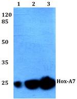 HOXA7 Antibody in Western Blot (WB)