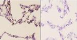 SIAH1/SIAH2 Antibody in Immunohistochemistry (Paraffin) (IHC (P))