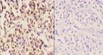 SIAH1/SIAH2 Antibody in Immunohistochemistry (Paraffin) (IHC (P))