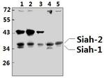 SIAH1/SIAH2 Antibody in Western Blot (WB)