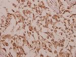 CHKB Antibody in Immunohistochemistry (Paraffin) (IHC (P))